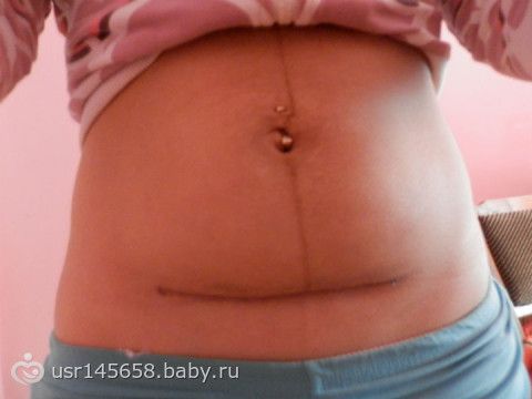 Живот вздулся признаки беременности