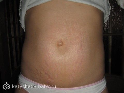 Пятна на теле лечение в домашних условиях Пятна на теле лечение в домашних условиях