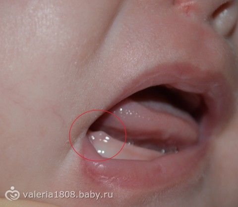 Могут ли первыми зубами вылезти клыки Могут ли первыми зубами вылезти клыки