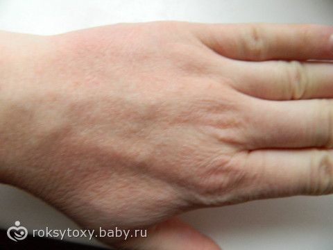 Мелкая сыпь на руках и ногах зуд Мелкая сыпь на руках и ногах зуд