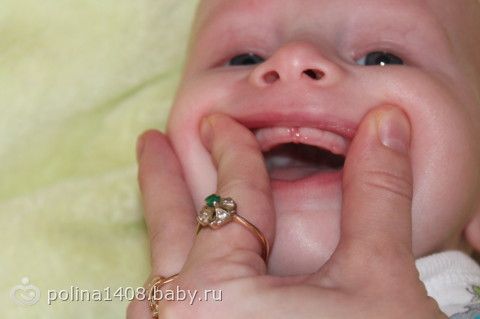 Шацкая - Библия стервы. Читать онлайн Фолликулярный кератоз, себорейный кератоз кожи - лечение и