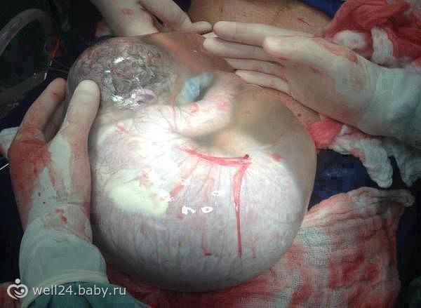 Откуда вылазиет ребенок при родах фото Откуда вылазиет ребенок при родах фото