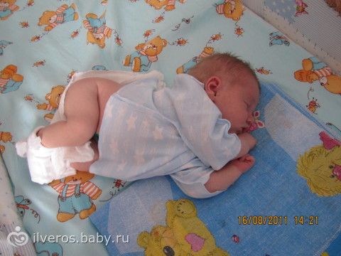 Детские поражения кожи Детские поражения кожи