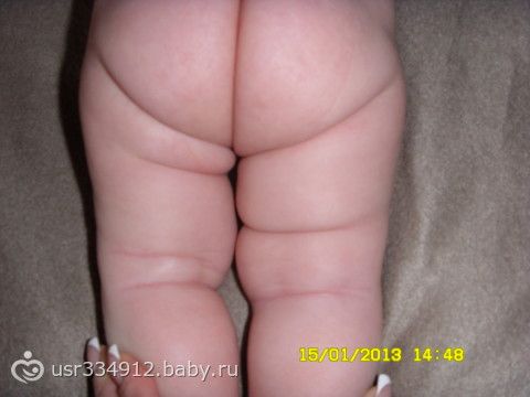 На ногах разное количество складок На ногах разное количество складок