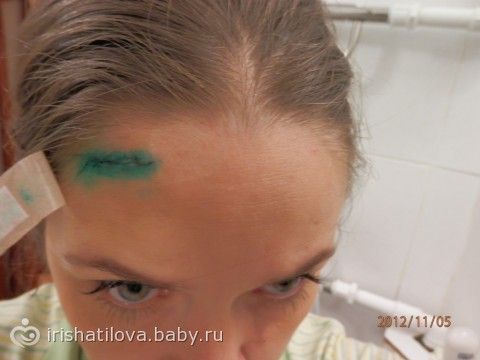 жировик на лбу фото онлайн жировик на лбу фото