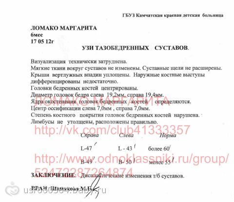 Сбор закрыт. Нужна срочно помощь Маргарите Ломако
