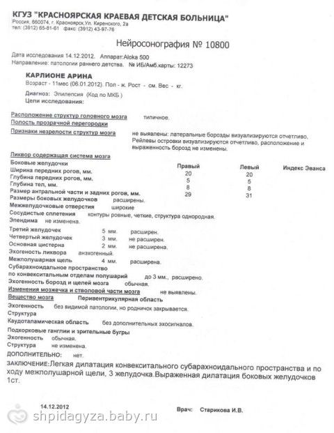 Открыт новый сбор на реабилитацию в г.Анапа (Витязево). Карлионе Арина 06.01.2012 г/р!!! ДЦП+ЭПИЛЕПСИЯ ВЕСТА. Сбор средств до 1 мая 2014. Сумма к сбору 133 тыс. 300 рублей
