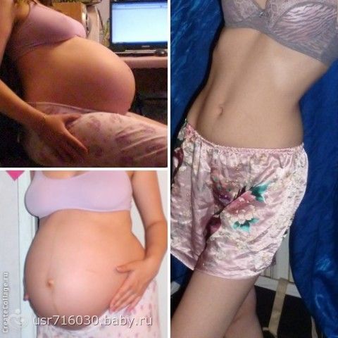 Живот после родов первый день