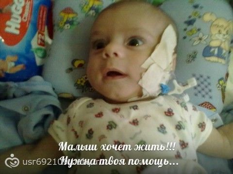 САЛТАНОВСКИЙ ТИМОШКА 9 месяцев.СПАСЕМ ЖИЗНЬ!Болезнь гиршпрунга.