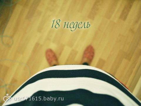 Чуду в моем животе 18 недель.