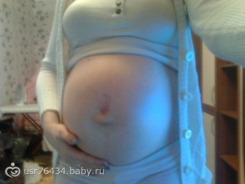 Наши 37 неделек)))))
