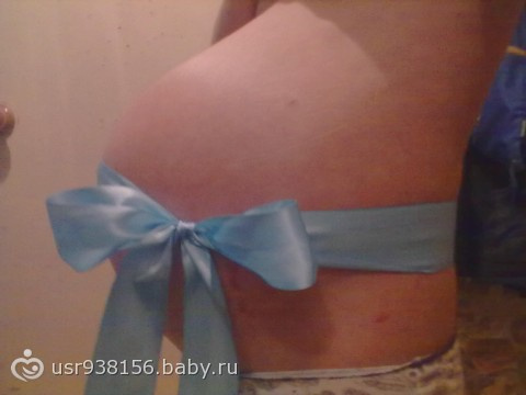 36 недель. Когда родим. Фото+Вопрос