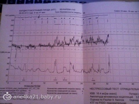 Тонус на 39 неделе беременности